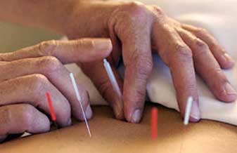 Vlademir Acupuntura - Foto 1