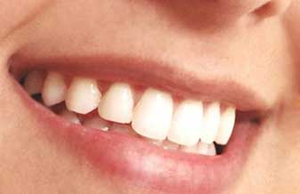 Maximpalnte Clinica de implante Dental - Foto 1