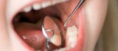 odontopediatria-sao-vicente-1488539208